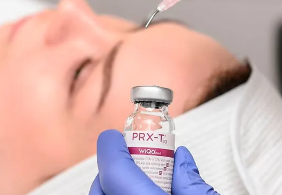 PRX-T33 Peel in Chicago & Northalsted | Revitalize Skin at Vesper